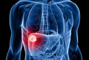 28 липня-Всесвітній день боротьби з вірусними гепатитами