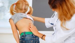 Міжнародний день боротьби зі сколіозом