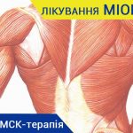 МІОПАТІЯ МІОПАТІЯ