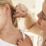 ПРОФІЛАКТИКА ГРИБКОВИХ ЗАХВОРЮВАНЬ СЕРЕД ДІТЕЙ ПРОФІЛАКТИКА ГРИБКОВИХ ЗАХВОРЮВАНЬ СЕРЕД ДІТЕЙ