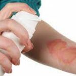 Опік - травма