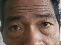 Обережно: лептоспіроз - небезпечне захворювання!