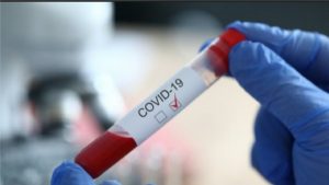 Динаміка поширення COVID-19 за тиждень на Хмельниччині позитивна, проте летальність — зросла