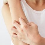 Чому виникає псоріаз?