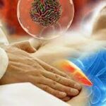 Вірусний гепатит А