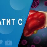 Гепатит С - симптоми, діагностика, лікування