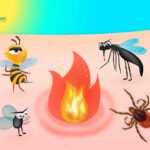 Що робити, якщо Вас укусила комаха?