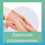 Варикоз Варикоз