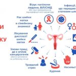 Не лише інфекції та генетика: що збільшує ризик появи раку шийки матки Не лише інфекції та генетика: що збільшує ризик появи раку шийки матки