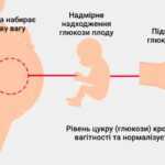 Діабет вагітних або гестаційний діабет