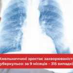 На Хмельниччині зростає захворюваність на туберкульоз: за 9 місяців – 315 випадків