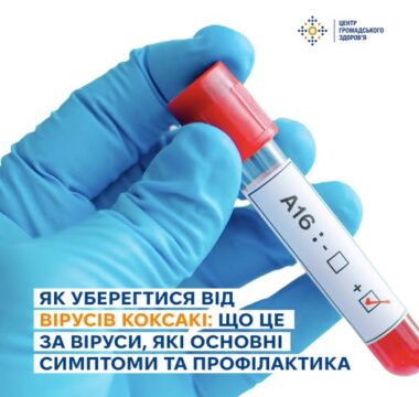 Віруси Коксакі