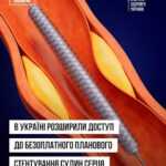 В Україні розширили доступ до безоплатного планового стентування судин серця В Україні розширили доступ до безоплатного планового стентування судин серця