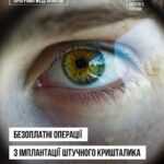 Безоплатні операції з імплантації штучного кришталика: як скористатися послугою Безоплатні операції з імплантації штучного кришталика: як скористатися послугою