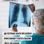 Що потрібно знати про шляхи інфікування туберкульозом і його лікування Що потрібно знати про шляхи інфікування туберкульозом і його лікування