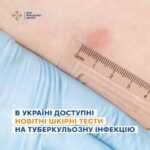 В Україні доступні новітні шкірні тести на туберкульозну інфекцію В Україні доступні новітні шкірні тести на туберкульозну інфекцію