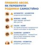 Правило ABCDE. Як перевірити родимки самостійно