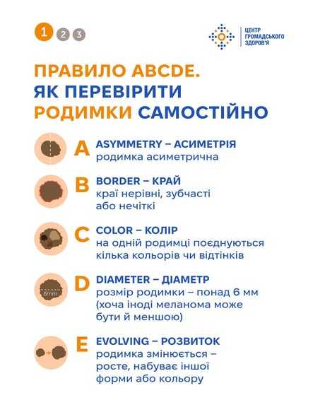 Правило ABCDE. Як перевірити родимки самостійно