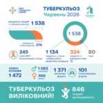 У червні 2026 року в Україні зареєстровано 1 538 людей з туберкульозом (ТБ) У червні 2026 року в Україні зареєстровано 1 538 людей з туберкульозом (ТБ)