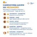 Меланома