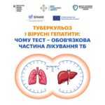 Під час лікування туберкульозу важливо контролювати не лише стан легень, а й здоров'я печінки Під час лікування туберкульозу важливо контролювати не лише стан легень, а й здоров'я печінки